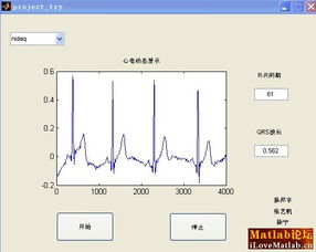 nidaq产品对心电数据进行采集及后续处理